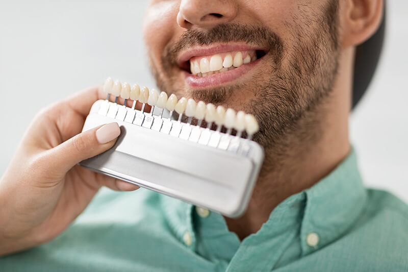 What are Dental Veneers? (Que son las Carillas Dentales?)